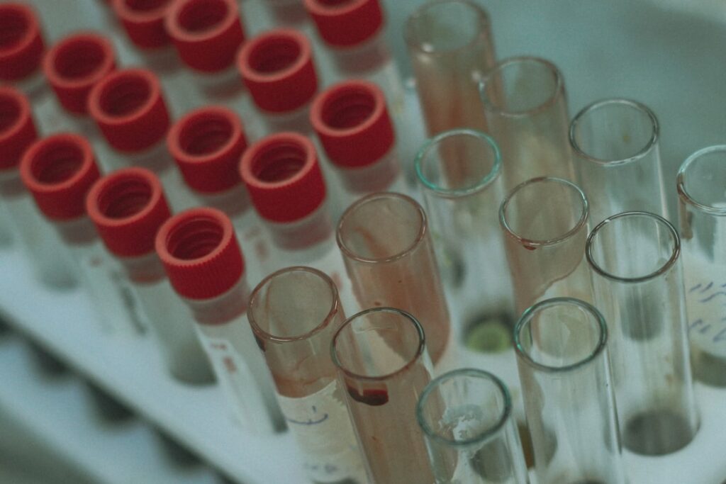 Lab test sample