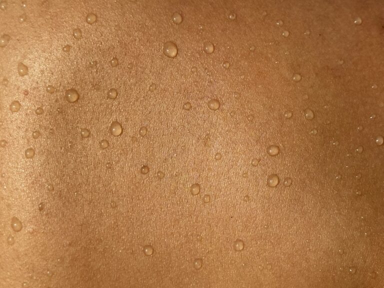 Mold on Skin: Symptoms, Causes, and What to Do
